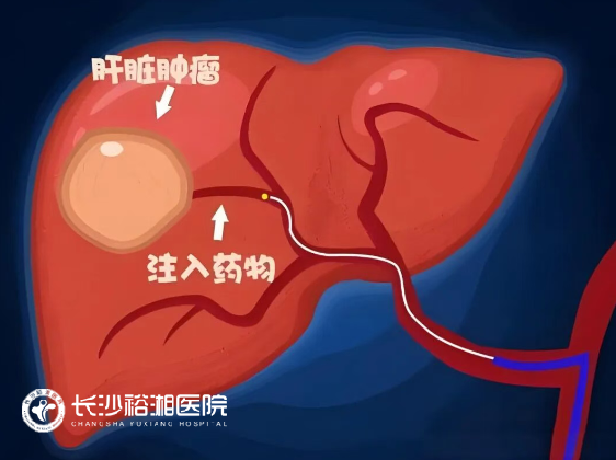 1762503313193216.png image.png